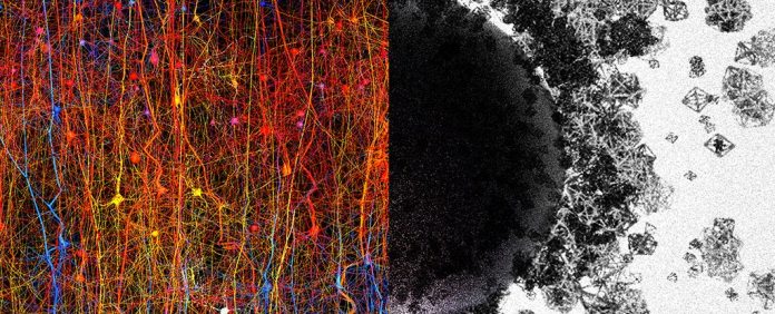 brain-algebraic-topology-frontiers_1024