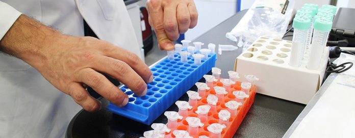 cancer-de-prostata-urina