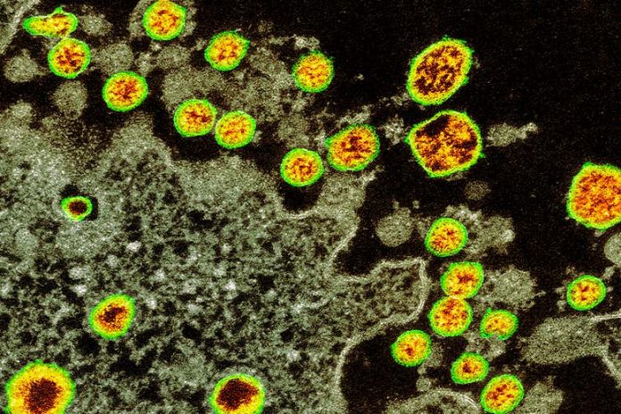 c0482483-covid-19_coronavirus_tem_web