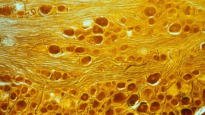 Primary Sensory Ganglion, LM