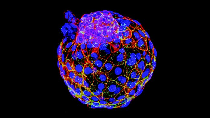 ca_0319NID_Blastoid_online