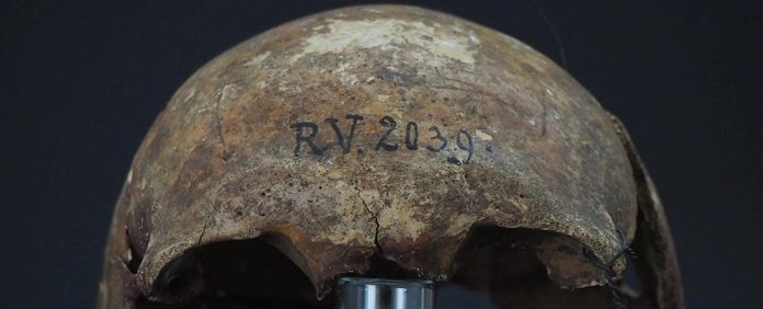peste-negra-vitima-cranio-pre-historia