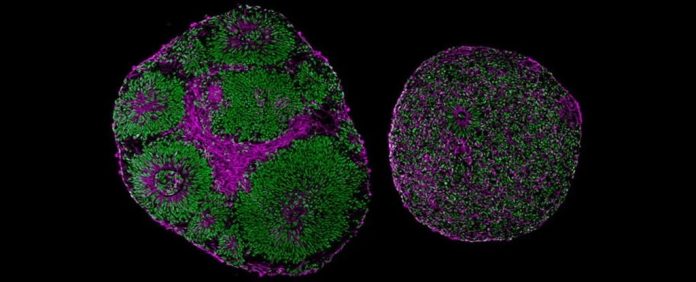 cerebros-laboratorio-gene-autismo