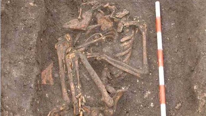 eremita-religiosa-medieval-sifilis