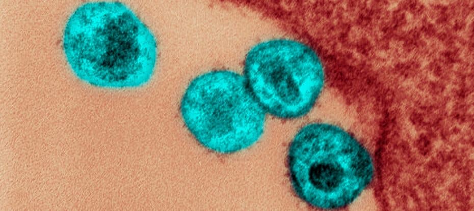 Imagens de micrografia eletrônica de transmissão de partículas de HIV (azul). (Callista Images/Getty Images)