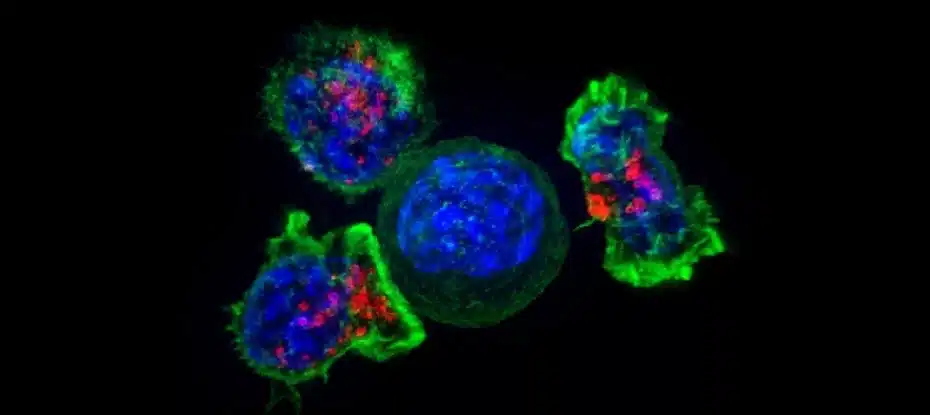 Células T assassinas cercam uma célula cancerosa. (Galeria de imagens do NIH/Flickr/Domínio público)