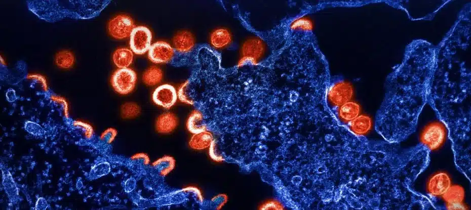 Partículas do vírus HIV