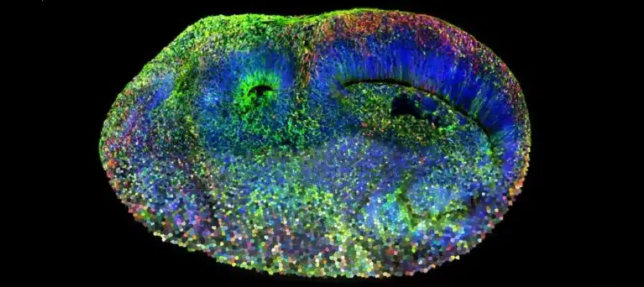 Cérebro artificial revela as origens genéticas do transtorno do espectro do autismo