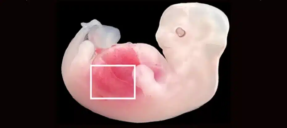 Primeiro no mundo: rins cultivados com células humanas em embriões de porcos