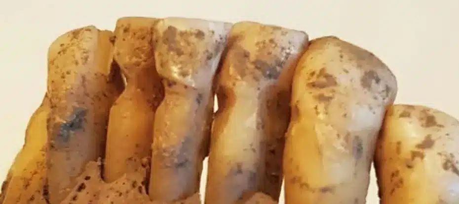 Cientistas estudaram 3.000 dentes Vikings e descobriram uma odontologia surpreendentemente avançada